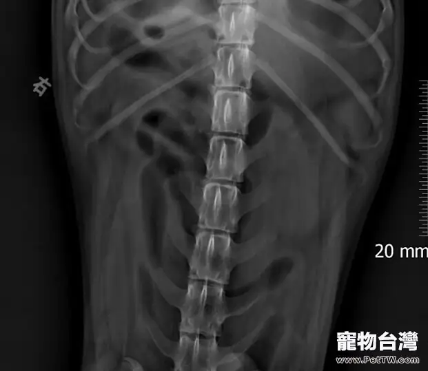 靈緹胰腺炎的診療體會