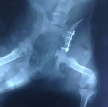流浪狗的骨盆骨折並脛腓骨骨裂病例